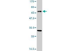 anti-Excision Repair Cross-Complementing Rodent Repair Deficiency, Complementation Group 2 (ERCC2) (AA 1-405) antibody