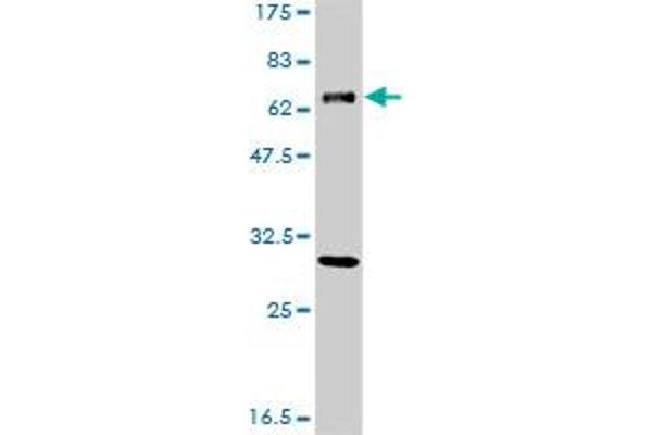 anti-Excision Repair Cross-Complementing Rodent Repair Deficiency, Complementation Group 2 (ERCC2) (AA 1-405) antibody