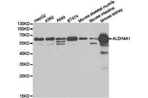 Image no. 1 for anti-Aldehyde Dehydrogenase 4 Family, Member A1 (ALDH4A1) antibody (ABIN1870929)