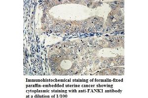 Image no. 1 for anti-Fibronectin Type III and Ankyrin Repeat Domains 1 (FANK1) antibody (ABIN6584324)