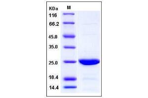Image no. 1 for Baculoviral IAP Repeat Containing 2 (BIRC2) (AA 144-356), (BIR2 Domain), (BIR3 Domain) (Active) protein (AVI tag) (ABIN2003966)