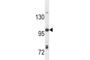 Image no. 1 for anti-Toll-Like Receptor 7 (TLR7) (AA 98-128) antibody (ABIN3029179)