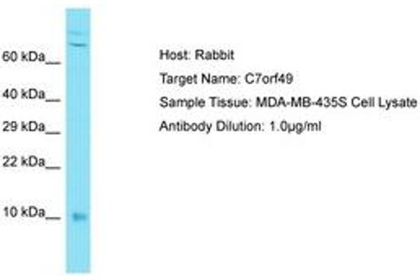 anti-Chromosome 7 Open Reading Frame 49 (C7ORF49) (AA 8-57) antibody