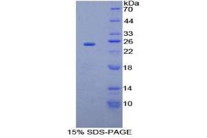 Image no. 1 for Sprouty Homolog 2 (SPRY2) (AA 116-305) protein (His tag) (ABIN1878241)