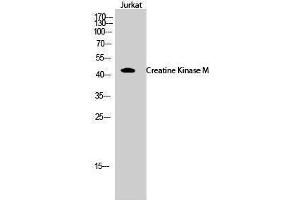 Image no. 1 for anti-Creatine Kinase, Muscle (CKM) (N-Term) antibody (ABIN3184074)
