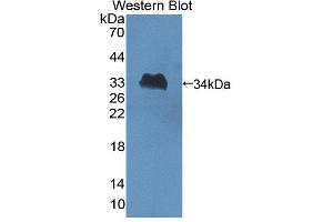 Image no. 1 for anti-Schlafen Family Member 5 (SLFN5) (AA 658-891) antibody (ABIN5014293)