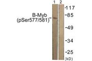 Western blot analysis of extracts from K562 cells, using B-Myb (Phospho-Ser577/581) Antibody.