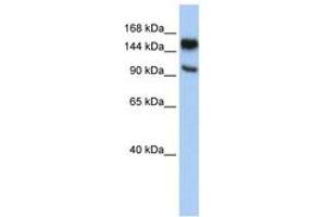 Image no. 1 for anti-Poly (ADP-Ribose) Polymerase Family, Member 10 (PARP10) (C-Term) antibody (ABIN6743128)