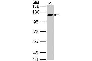 Image no. 3 for anti-Cylindromatosis (Turban Tumor Syndrome) (CYLD) (C-Term) antibody (ABIN2854660)
