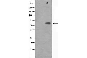 Image no. 3 for anti-Kruppel-Like Factor 11 (KLF11) (N-Term) antibody (ABIN6262840)