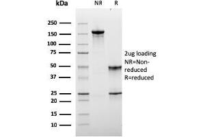 Image no. 1 for anti-Lymphocyte-Activation Gene 3 (LAG3) antibody (ABIN6939954)