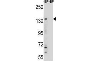 Image no. 1 for anti-Lysine (K)-Specific Demethylase 6B (Kdm6b) (AA 954-987) antibody (ABIN3031662)