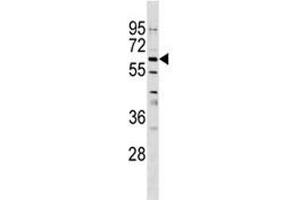 Image no. 2 for anti-Osteoactivin (GPNMB) (AA 541-569) antibody (ABIN3032103)