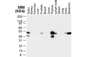 Image no. 3 for anti-TNF Receptor-Associated Factor 1 (TRAF1) (AA 1-22) antibody (ABIN957233)