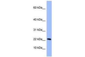 Image no. 1 for anti-Peptidyl Prolyl Cis/Trans Isomerase NIMA Interacting 4 Protein (PIN4) (C-Term) antibody (ABIN6741813)
