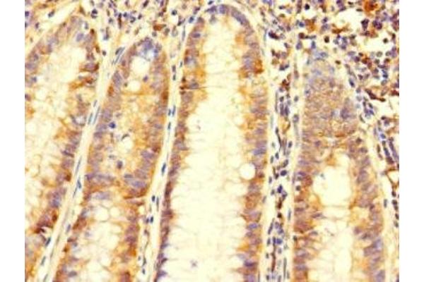 C6orf89 antibody  (AA 120-320)