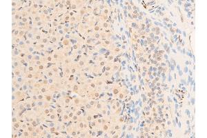 Image no. 13 for anti-serum/glucocorticoid Regulated Kinase 1 (SGK1) (pSer422) antibody (ABIN6256329)
