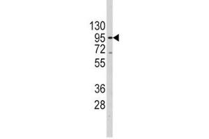Image no. 3 for anti-Telomerase Reverse Transcriptase (TERT) (AA 627-656) antibody (ABIN3029108)