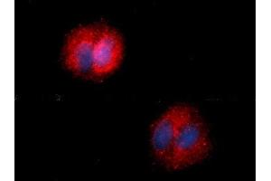 Image no. 2 for anti-Fatty Acid Binding Protein 5 (Psoriasis-Associated) (FABP5) (AA 1-135) antibody (PE) (ABIN5567755)