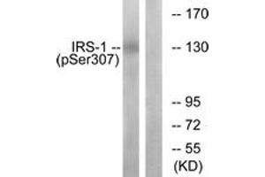 Image no. 1 for anti-Insulin Receptor Substrate 1 (IRS1) (AA 274-323), (pSer307) antibody (ABIN1531876)