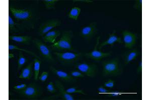 Image no. 3 for anti-Phosducin-Like 3 (PDCL3) (AA 1-239) antibody (ABIN528862)