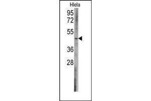 Image no. 1 for anti-BCL2-Like 13 (Apoptosis Facilitator) (BCL2L13) (C-Term) antibody (ABIN360243)