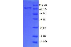 Image no. 1 for Dolichyl-diphosphooligosaccharide--Protein Glycosyltransferase (DDOST) (AA 44-427), (partial) protein (GST tag) (ABIN1046936)