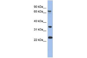 Image no. 1 for anti-TBC1 Domain Family, Member 25 (TBC1D25) (N-Term) antibody (ABIN2786665)