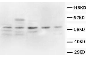 Image no. 2 for anti-Prostaglandin-Endoperoxide Synthase 2 (Prostaglandin G/H Synthase and Cyclooxygenase) (PTGS2) (AA 26-41), (N-Term) antibody (ABIN3044295)