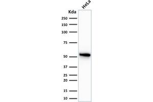 Image no. 1 for anti-Keratin 7 (KRT7) antibody (ABIN6939871)