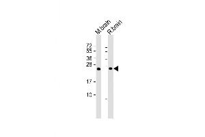 Image no. 1 for anti-RAB3A, Member RAS Oncogene Family (RAB3A) antibody (ABIN4913400)