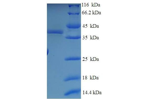 Oligonucleotide/oligosaccharide-Binding Fold Containing 2A (OBFC2A) (AA 1-204), (full length) protein (His-SUMO Tag)