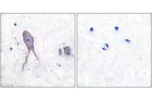 Image no. 2 for anti-Notch 2 (NOTCH2) (AA 1684-1733), (Cleaved-Asp1733) antibody (ABIN1536095)