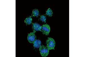 Image no. 3 for anti-Interleukin 8 (IL8) antibody (ABIN2488065)