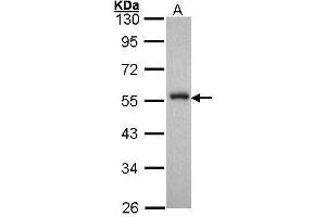 Image no. 4 for anti-Forkhead Box A1 (FOXA1) (C-Term) antibody (ABIN2854707)