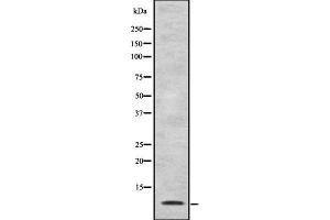 Image no. 1 for anti-Chemokine (C-C Motif) Ligand 22 (CCL22) (Internal Region) antibody (ABIN6260541)