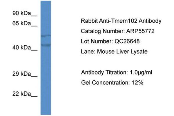 TMEM102 antibody  (N-Term)
