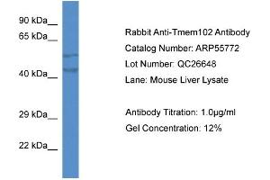 Image no. 1 for anti-Transmembrane Protein 102 (TMEM102) (N-Term) antibody (ABIN2786357)