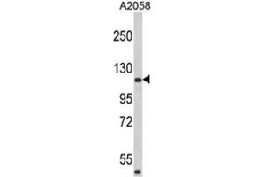Image no. 1 for anti-Histocompatibility (Minor) HA-1 (HMHA1) (Middle Region) antibody (ABIN453107)