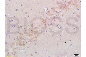 Formalin-fixed and paraffin embedded: rat brain tissue labeled with Anti-Nogo-A Polyclonal Antibody (ABIN725480), Unconjugated at 1:200 followed by conjugation to the secondary antibody and DAB staining