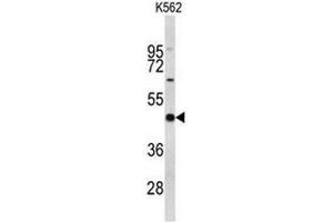 Image no. 4 for anti-Eukaryotic Translation Initiation Factor 4A2 (EIF4A2) (AA 339-369), (C-Term) antibody (ABIN952052)
