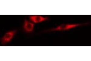 Image no. 2 for anti-CDC42 Effector Protein (Rho GTPase Binding) 4 (CDC42EP4) antibody (ABIN6258384)