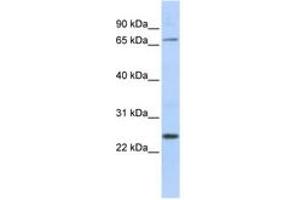 Image no. 1 for anti-Zinc Finger Protein 835 (ZNF835) (AA 306-355) antibody (ABIN6742669)