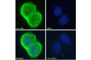 Image no. 5 for anti-Mast/stem Cell Growth Factor Receptor (KIT) (Internal Region) antibody (ABIN1589992)