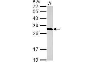 Image no. 5 for anti-Calbindin 2 (CALB2) (Center) antibody (ABIN2855596)