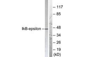 Image no. 2 for anti-Nuclear Factor of kappa Light Polypeptide Gene Enhancer in B-Cells Inhibitor, epsilon (NFKBIE) (AA 131-180) antibody (ABIN2888569)