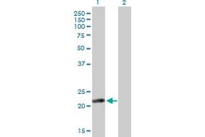 Image no. 2 for anti-Isochorismatase Domain Containing 2 (ISOC2) (AA 1-205) antibody (ABIN529040)
