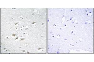 Image no. 2 for anti-Zinc Finger E-Box Binding Homeobox 2 (ZEB2) (AA 71-120) antibody (ABIN1533518)