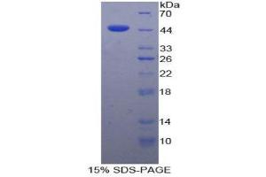 Image no. 1 for Fibroblast Growth Factor 7 (FGF7) (AA 32-194) protein (His tag,GST tag) (ABIN1877549)
