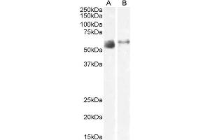Image no. 1 for anti-Solute Carrier Family 7 (Amino Acid Transporter Light Chain, Y+L System), Member 7 (Slc7a7) (N-Term) antibody (ABIN6391414)